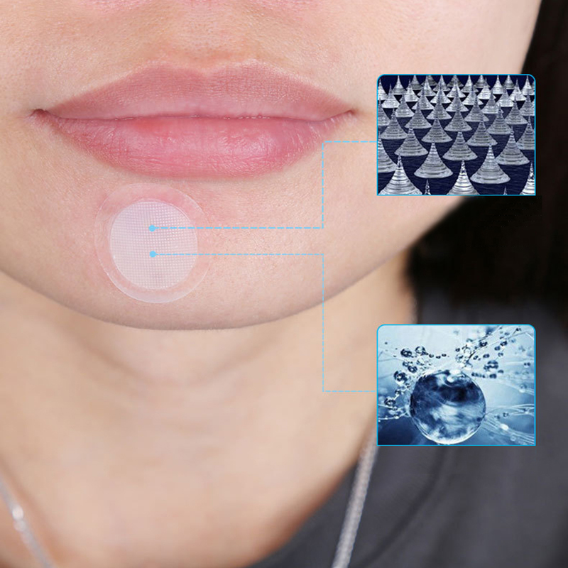 Img